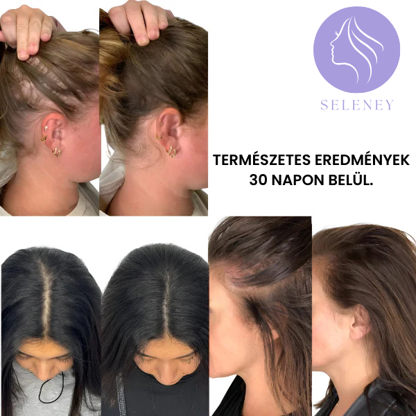 Seleney™ - 4in1 Gyógyfésű